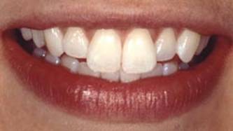Dentists in Naples Fl